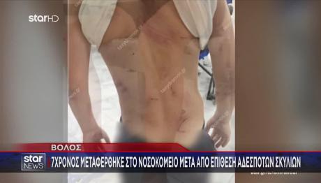 Βόλος: Στο νοσοκομείο 7χρονος μετά από επίθεση σκυλιών