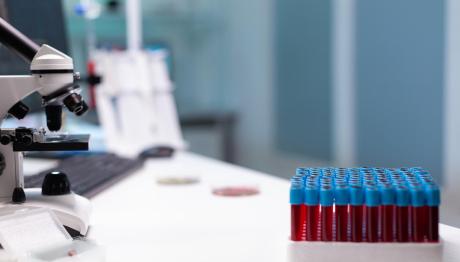 Αιμορραγικός Πυρετός: Τι Λέει Ο Επιδημιολόγος Δ. Παρασκευής