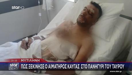 Μυτιλήνη: Έχει Τρύπες Σε Πνεύμονα, Διάφραγμα - Κόπηκαν Μύες