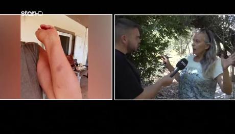 Ηλεία: Ξυλοδαρμός Γυναίκας Που Κατήγγειλε Κακοποίηση Σκύλου