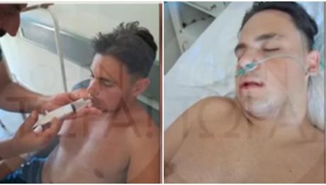 Βόνιτσα: Ξυλοκόπησαν 18χρονο - Του Έσπασαν Το Σαγόνι