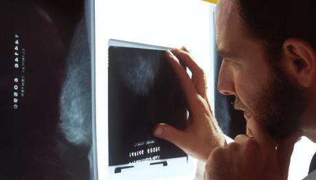 Καρκίνος του Προστάτη