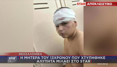 Θεσσαλονίκη: 13χρονος Δέχθηκε Άγρια Επίθεση