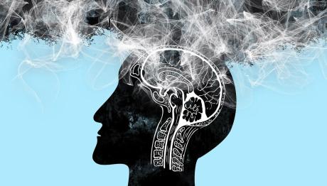 Alzheimer