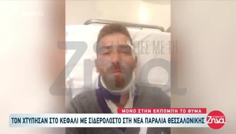 Θεσσαλονίκη: Τον Χτύπησαν Με Σιδηρολοστό Στο Κεφάλι