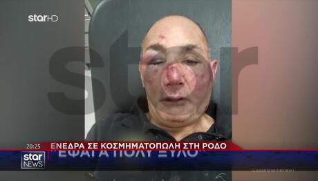 Ενέδρα Σε Κοσμηματοπώλη Στη Ρόδο: «Έφαγα Πολύ Ξύλο»