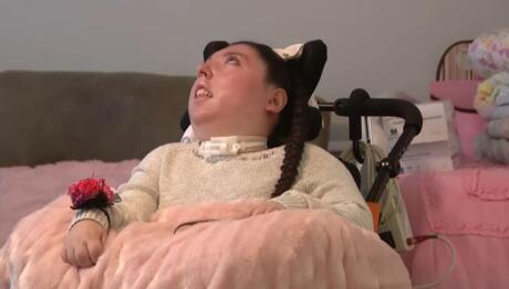 Κορίτσι Γεννήθηκε Χωρίς Εγκέφαλο Και Ζει 20 Χρόνια!