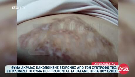 Με Έκαιγε Στο Καλοριφέρ: Τα Βασανιστήρια Της Μαρίας