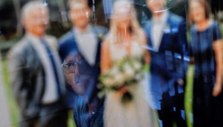 Αυτοάνοση Εγκεφαλίτιδα: Όταν Το Σώμα Σκοτώνει Τις Αναμνήσεις