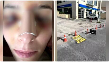 Ηράκλειο: Ταμπέλα Έπεσε Στο Κεφάλι 29χρονης