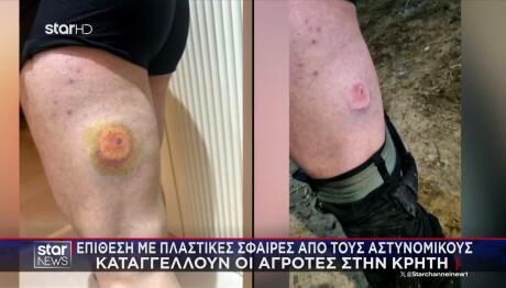 Κρήτη: Επίθεση Της ΕΛΑΣ Με Πλαστικές Σφαίρες Σε Αγρότες