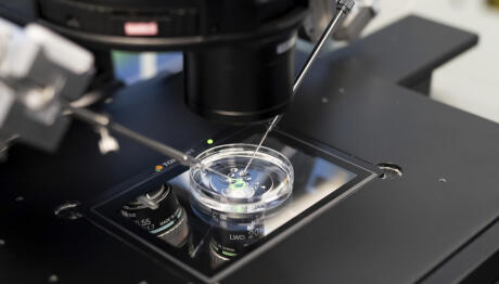 197 Παιδιά Γεννήθηκαν Με Σπέρμα Με Καρκινικό Γονίδιο