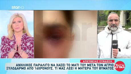 Ιωάννινα: Ο 16χρονος Που Ξυλοκοπήθηκε Έχει Θυμό