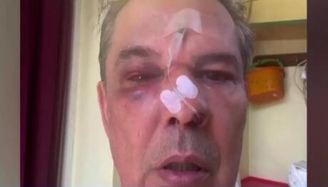 Χαϊδάρι: Επιτέθηκε Σε Άνδρα Γιατί Του Έκανε Παρατήρηση