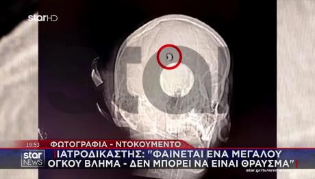 Άργος:Ένας Αστυνομικός Παραδέχεται Ότι Πυροβόλησε Στον Τοίχο