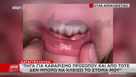 «Πήγα Για Καθαρισμό Προσώπου Και...»:Καταγγελία Σοκ Στο Star