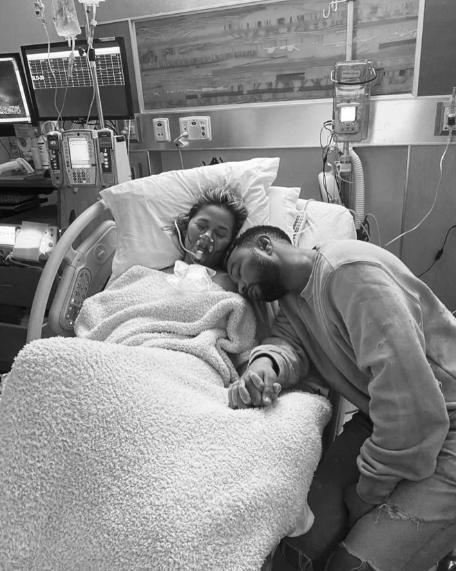  Chrissy Teigen John Legend έχασαν το μωρό