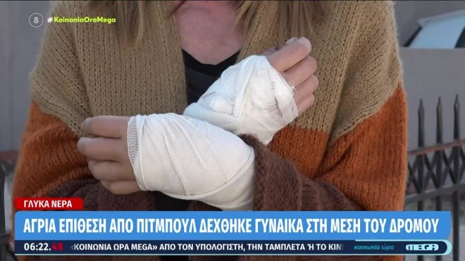 Tα χέρια της γυναίκας μετά την επίθεση- από βίντεο mega