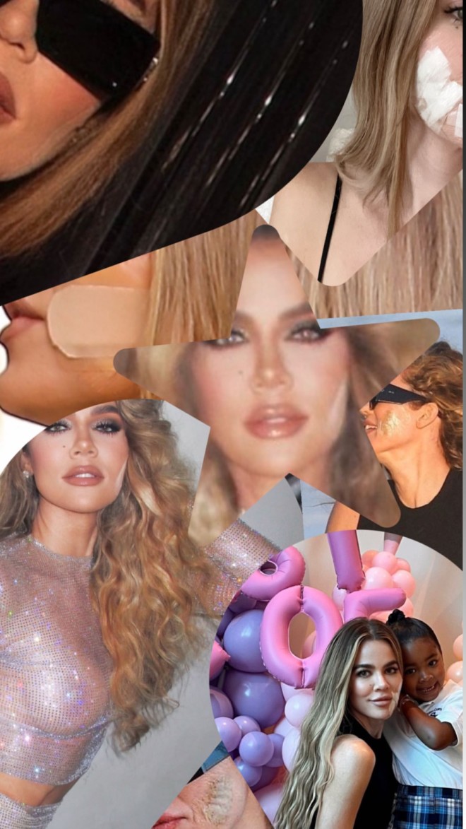 Η Khloe Kardashian αφαίρεσε όγκο από το μάγουλό της