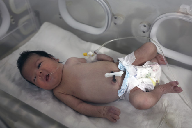 Η Αya στο νοσοκομείο όπου νοσηλεύτηκε μετά τη γέννησή της- ΑΡ