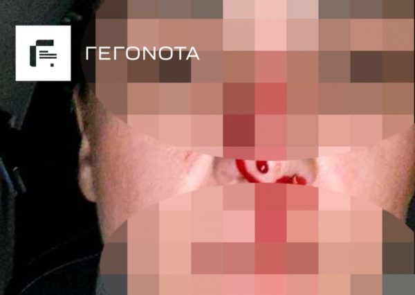 Σοκάρουν οι εικόνες της γυναίκας που κακοποιήθηκε από τον αθλητή πρώην σύζυγό της - gegonota.news