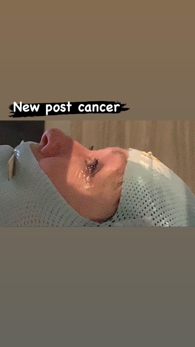 Η Σάνεν Ντόχερτι δίνει μάχη με τον καρκίνο