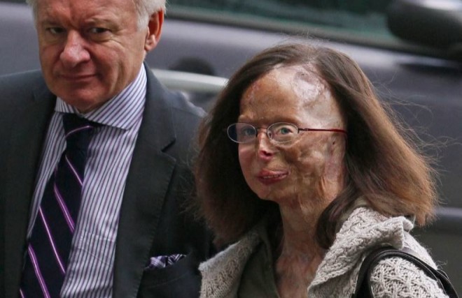 Η 59χρονη Patricia Lefranc δέχτηκε επίθεση με οξύ από τον πρώην σύντροφό της, το 2009/screenshot Reuters