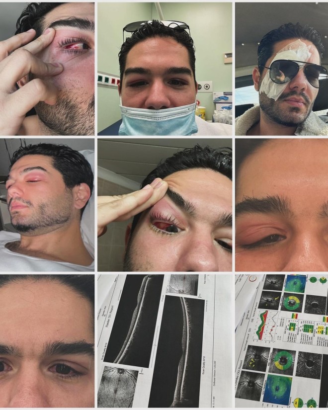 Χρήστος Μάστορας: Η σοβαρή περιπέτεια με την υγεία του -Ανέβασε φωτογραφίες