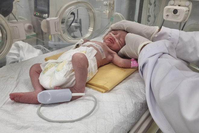 Γάζα: Μωρό γεννήθηκε με καισαρική αφού πέθανε η μητέρα του