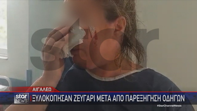 Η γυναίκα που τραυματίσθηκε όπως και ο σύζυγός της μετά την επίθεση που δέχθηκαν    
