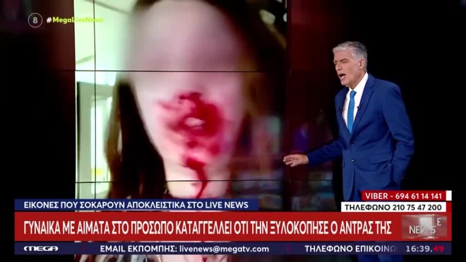 Σοκ στην Άμφισσα: Περιγράφει αιμόφυρτη τον ξυλοδαρμό από τον σύζυγό της