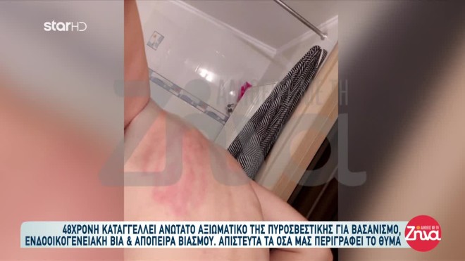 Γυναίκα καταγγέλλει ανώτατο αξιωματικό της Πυροσβεστικής για βαριά κακοποίηση και βασανιστήρια