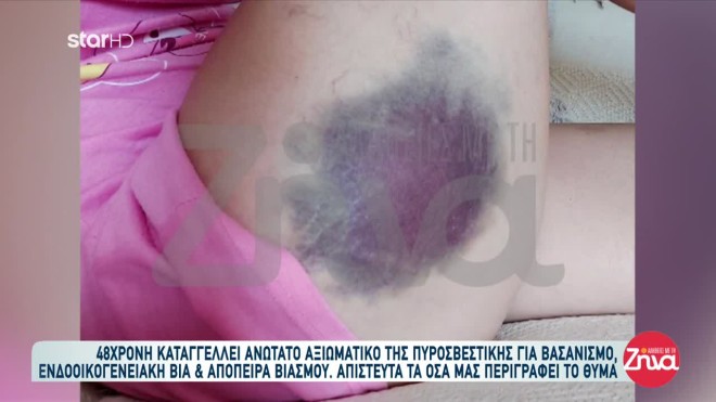 Καταγγελία για ξυλοδαρμό από αξιωματικό πυροσβεστικής
