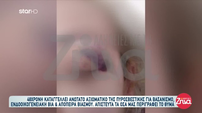 Καταγγελία Για Βασανιστήρια Από Αξιωματικό Πυροσβεστικής