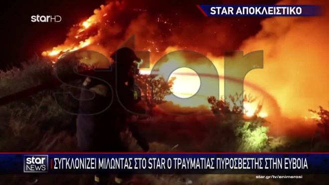 Τραυματίας πυροσβέστης δείχνει στο Star τα σημάδια που του άφησε η φωτιά