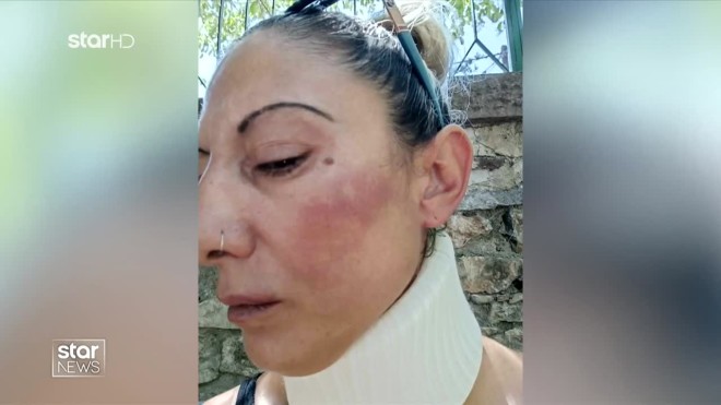 Λέσβος: Πυροσβέστης ξυλοκόπησε τη σύντροφό του