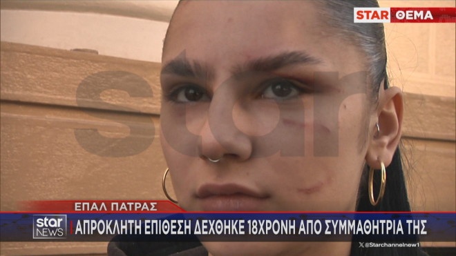 Ξεσπά στο Star η 18χρονη που δέχθηκε άγρια επίθεση σε σχολείο της Πάτρας