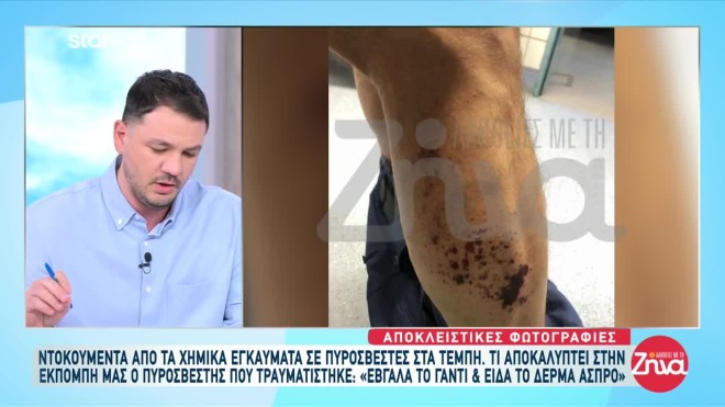 Τέμπη: Ντοκουμέντα από τα χημικά εγκαύματα των πυροσβεστών