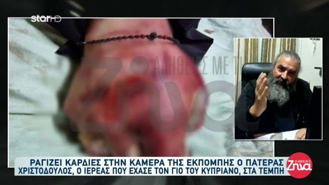 Το έγκαυμα στο χέρι του Κυπριανού 