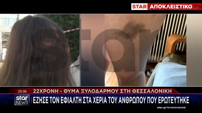 H 22χρονη που έπεσε θύμα ξυλοδαρμού στη Θεσσαλονίκη μιλά στο STAR