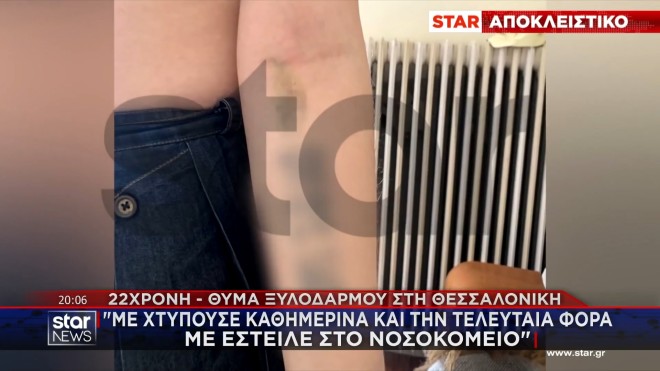 H 22χρονη που έπεσε θύμα ξυλοδαρμού στη Θεσσαλονίκη μιλά στο STAR