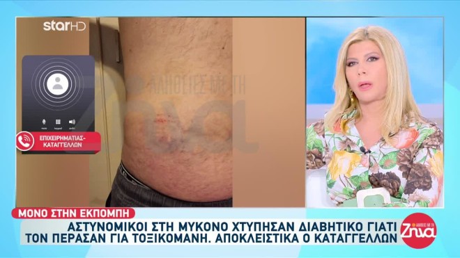 Μύκονος: Aστυνομικοί ξυλοκόπησαν διαβητικό - Τον πέρασαν για τοξικομανή!