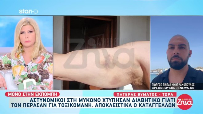 Ξυλοδαρμός διαβητικού στη Μύκονο