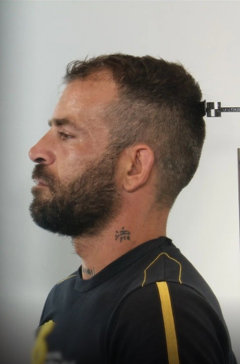 Βιασμός 16χρονη Πάτρα