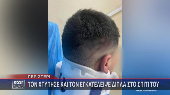 Ο μοτοσικλετιστής που τραυματίσθηκε από την παράσυρση  