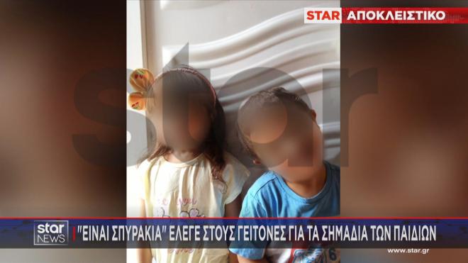 Λάρισα: Έσβηναν Τσιγάρα Σε Δύο Αδερφάκια