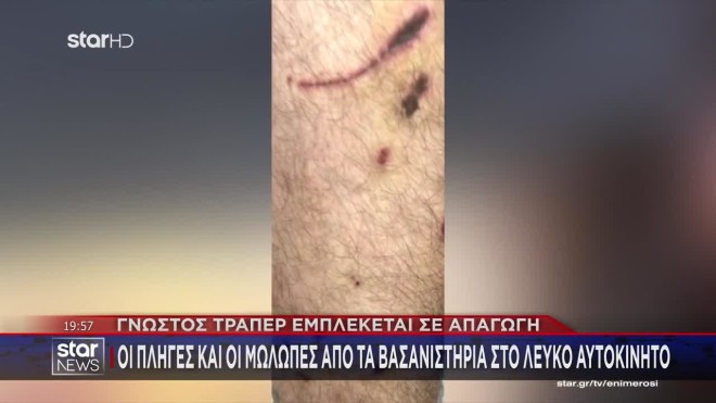 Εμπλοκή τράπερ σε απαγωγή: «Κατηγορούμενος και θύμα γνωρίζονταν χρόνια»