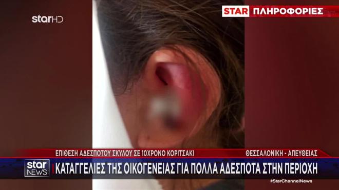 Επίθεση σκύλου σε 10χρονη 