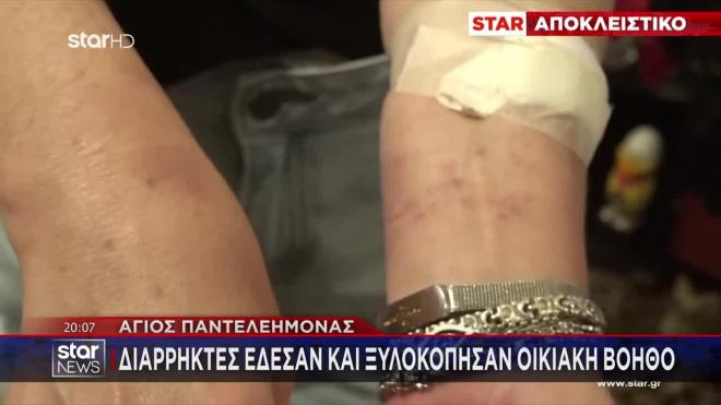 Χτύπησαν οικιακή βοηθό στον Άγιο Παντελεήμονα