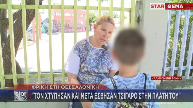 Φρίκη στη Θεσσαλονίκη: Ανήλικος έσβησε τσιγάρο σε 13χρονο μέσα στο σχολείο